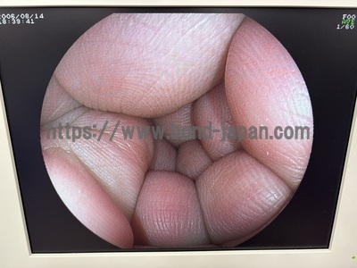Video Colonoscope&nbsp;|&nbsp;FUJIFILM&nbsp;|&nbsp;EC-590WM3