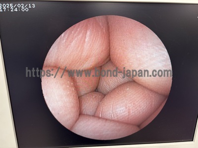Video Gastroscope&nbsp;|&nbsp;FUJIFILM&nbsp;|&nbsp;EG-530N