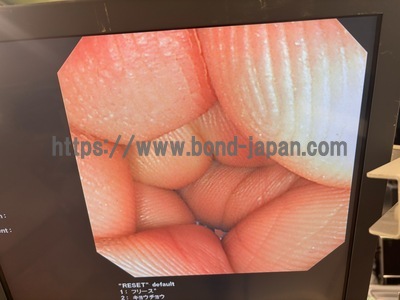 Video Colonoscope&nbsp;|&nbsp;OLYMPUS&nbsp;|&nbsp;CF-240I