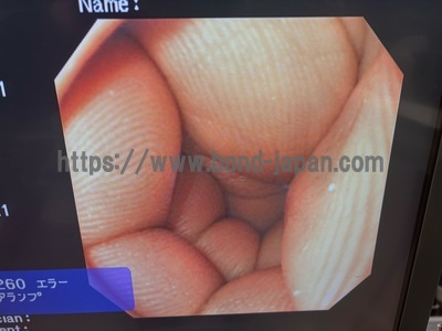 Video Gastroscope&nbsp;|&nbsp;OLYMPUS&nbsp;|&nbsp;GIF-XQ240