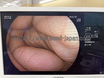 Video Gastroscope&nbsp;|&nbsp;FUJIFILM&nbsp;|&nbsp;EG-L600ZW