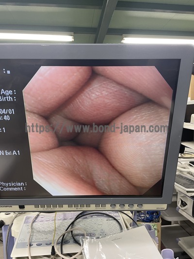 Video Gastroscope&nbsp;|&nbsp;OLYMPUS&nbsp;|&nbsp;GIF-XQ240