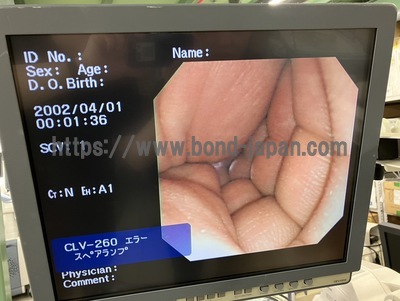 Video Gastroscope&nbsp;|&nbsp;OLYMPUS&nbsp;|&nbsp;GIF-XP260N