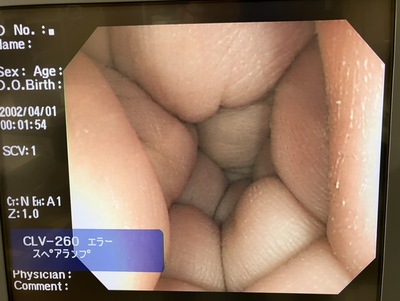 Video Colonoscope&nbsp;|&nbsp;OLYMPUS&nbsp;|&nbsp;CF-Q260AI