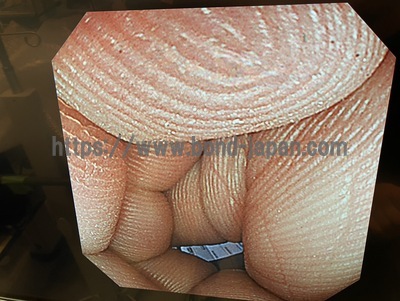 Video Colonoscope&nbsp;|&nbsp;OLYMPUS&nbsp;|&nbsp;CF-240I