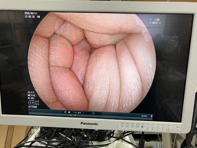 Video Gastroscope&nbsp;|&nbsp;FUJIFILM&nbsp;|&nbsp;EG-530NW