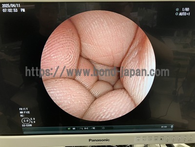 Video Gastroscope&nbsp;|&nbsp;FUJIFILM&nbsp;|&nbsp;EG-530N