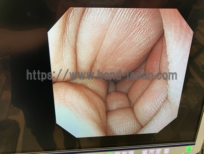 Video Gastroscope&nbsp;|&nbsp;OLYMPUS&nbsp;|&nbsp;GIF-XP290N