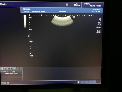 Color Doppler&nbsp;|&nbsp;CANON&nbsp;|&nbsp;Xario 200