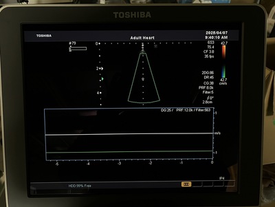 Color Doppler&nbsp;|&nbsp;CANON&nbsp;|&nbsp;SSA-660A Xario