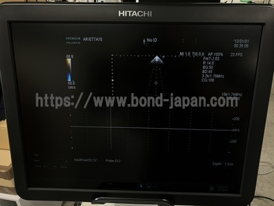 &nbsp;|&nbsp;Fujifilm&nbsp;|&nbsp;ARIETTA 70