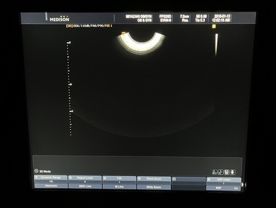 Ultrasound System&nbsp;|&nbsp;Samsung Medison&nbsp;|&nbsp;SONOACE R7