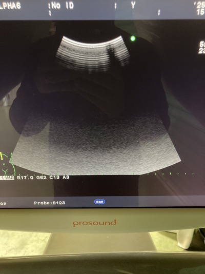 Color Doppler&nbsp;|&nbsp;HITACHI&nbsp;|&nbsp;Prosound α6