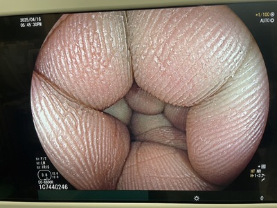 Colonoscope&nbsp;|&nbsp;FUJIFILM&nbsp;|&nbsp;EC-6600R