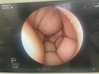 Video Gastroscope&nbsp;|&nbsp;FUJIFILM&nbsp;|&nbsp;EG-530N2