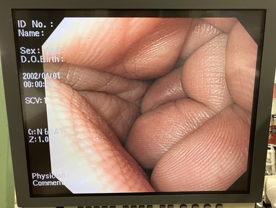 Video Gastroscope&nbsp;|&nbsp;OLYMPUS&nbsp;|&nbsp;GIF-H260