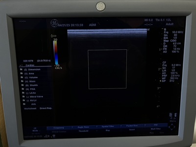 Color Doppler&nbsp;|&nbsp;GE&nbsp;|&nbsp;LOGIQ P5
