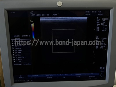 Color Doppler&nbsp;|&nbsp;GE&nbsp;|&nbsp;LOGIQ P5