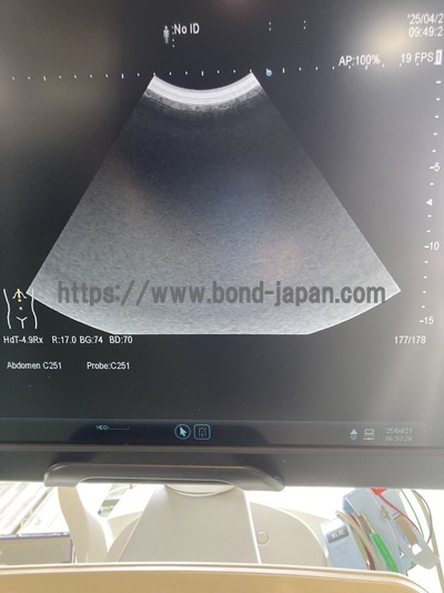 &nbsp;|&nbsp;Fujifilm&nbsp;|&nbsp;ARIETTA 70