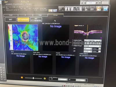  Optical Coherence Tomography ・OCT&nbsp;|&nbsp;NIDEK&nbsp;|&nbsp;RS-3000 Lite
