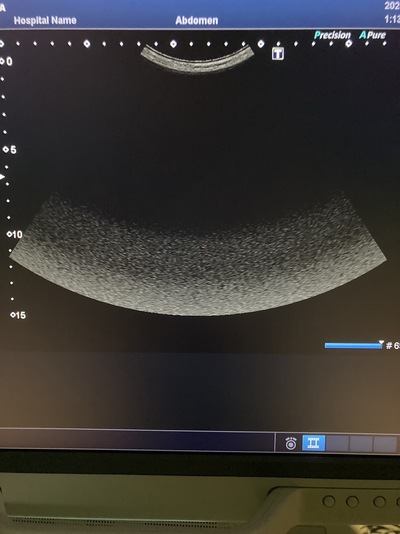 Color Doppler&nbsp;|&nbsp;CANON&nbsp;|&nbsp;Xario 200