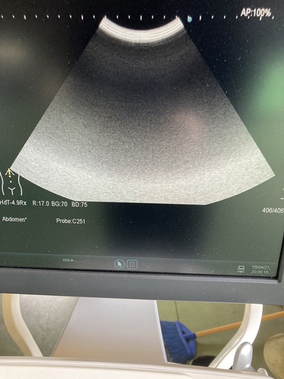 Ultrasound System&nbsp;|&nbsp;HITACHI&nbsp;|&nbsp;ARIETTA 60