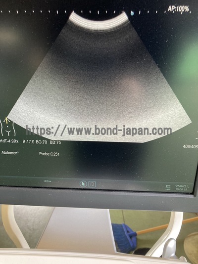 Ultrasound System&nbsp;|&nbsp;HITACHI&nbsp;|&nbsp;ARIETTA 60