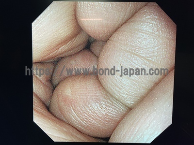 Video Gastroscope&nbsp;|&nbsp;OLYMPUS&nbsp;|&nbsp;GIF-XP290N