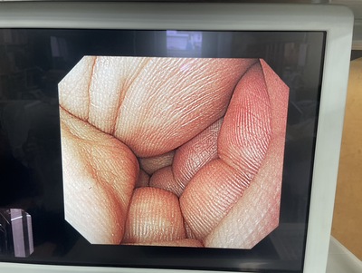 Video Gastroscope&nbsp;|&nbsp;OLYMPUS&nbsp;|&nbsp;GIF-H260