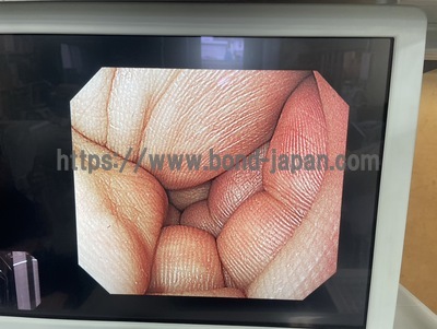 Video Gastroscope&nbsp;|&nbsp;OLYMPUS&nbsp;|&nbsp;GIF-H260