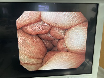 Video Gastroscope&nbsp;|&nbsp;OLYMPUS&nbsp;|&nbsp;GIF-H260