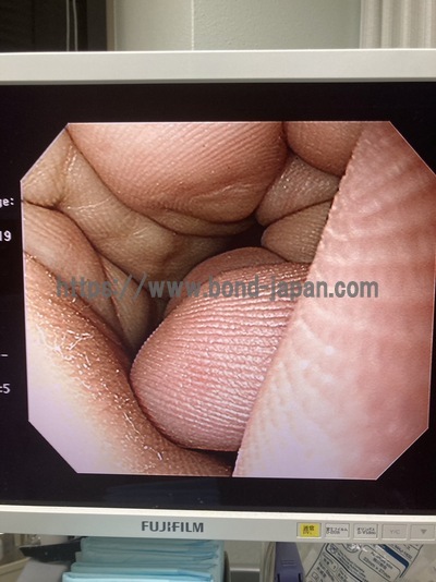 Video Gastroscope&nbsp;|&nbsp;OLYMPUS&nbsp;|&nbsp;GIF-H290