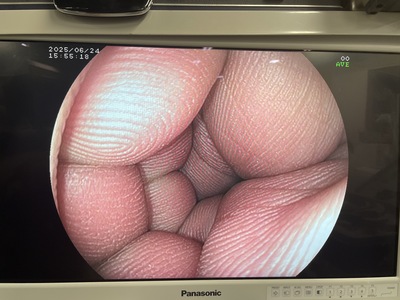 Endoscopy System&nbsp;|&nbsp;FUJIFILM&nbsp;|&nbsp;EPX-3200(2500)