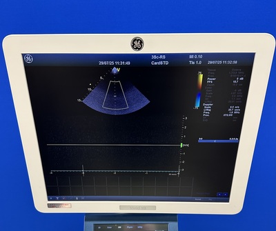 Ultrasound&nbsp;|&nbsp;GE&nbsp;|&nbsp;Vivid T8