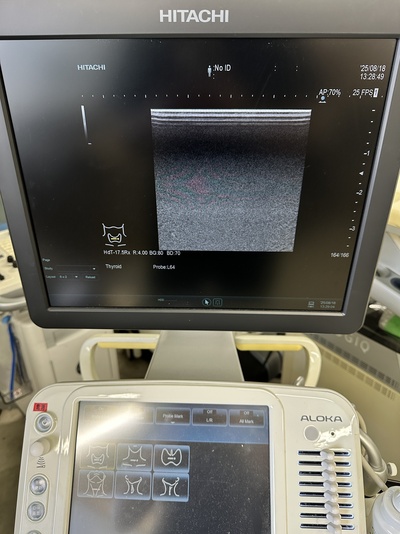 Ultrasound System&nbsp;|&nbsp;HITACHI&nbsp;|&nbsp;ARIETTA 60