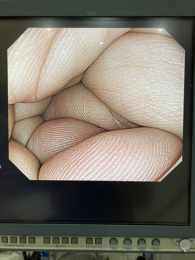 Video Gastroscope&nbsp;|&nbsp;OLYMPUS&nbsp;|&nbsp;GIF-H260Z