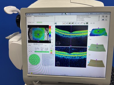 OCT&nbsp;|&nbsp;Carl Zeiss&nbsp;|&nbsp;Cirrus 500 HD-OCT Plus