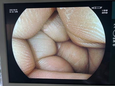 Endoscopy System&nbsp;|&nbsp;FUJIFILM&nbsp;|&nbsp;Lasereo 7000(VP-7000/LL-7000)