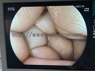 Endoscopy System&nbsp;|&nbsp;FUJIFILM&nbsp;|&nbsp;Lasereo 7000(VP-7000/LL-7000)