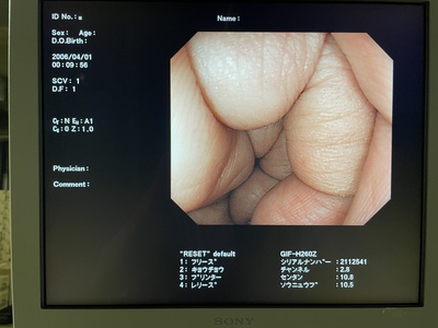 Video Gastroscope&nbsp;|&nbsp;OLYMPUS&nbsp;|&nbsp;GIF-H260Z