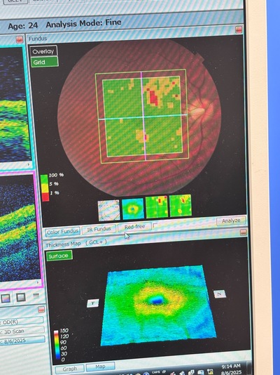 OCT with Non-mydriatic retinal camera&nbsp;|&nbsp;TOPCON&nbsp;|&nbsp;3D OCT 1 / Maestro 1