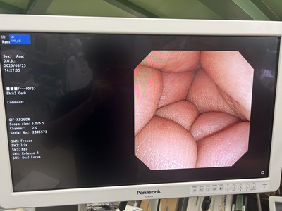 Video Gastroscope&nbsp;|&nbsp;OLYMPUS&nbsp;|&nbsp;GIF-XP260N