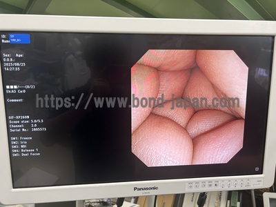 Video Gastroscope&nbsp;|&nbsp;OLYMPUS&nbsp;|&nbsp;GIF-XP260N