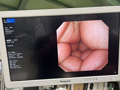 Video Gastroscope&nbsp;|&nbsp;OLYMPUS&nbsp;|&nbsp;GIF-XQ260