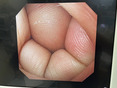 Video Gastroscope&nbsp;|&nbsp;OLYMPUS&nbsp;|&nbsp;GIF-XQ240