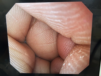 Video Gastroscope&nbsp;|&nbsp;OLYMPUS&nbsp;|&nbsp;GIF-Q240X