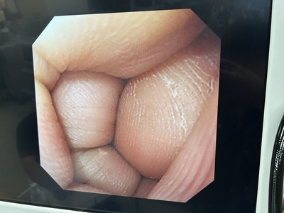 Video Gastroscope&nbsp;|&nbsp;OLYMPUS&nbsp;|&nbsp;GIF-XQ240