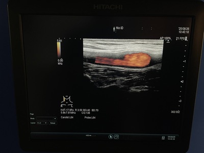 Ultrasound System&nbsp;|&nbsp;HITACHI&nbsp;|&nbsp;ARIETTA 60