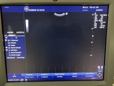 Color Doppler&nbsp;|&nbsp;GE&nbsp;|&nbsp;LOGIQ P5