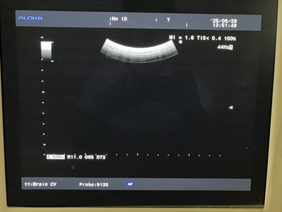 Ultrasound System&nbsp;|&nbsp;HITACHI&nbsp;|&nbsp;Prosound α7